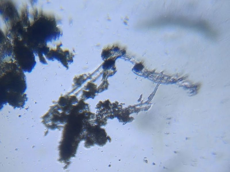 Diatoms in tadpole excreta observed under Foldscope.