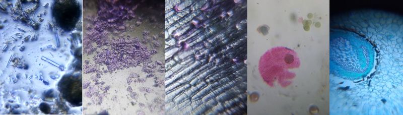 Some interesting patterns and designs from the natural world as seen from a Foldscope (Diatoms, animal tissue, onion cells and fern rhizome).