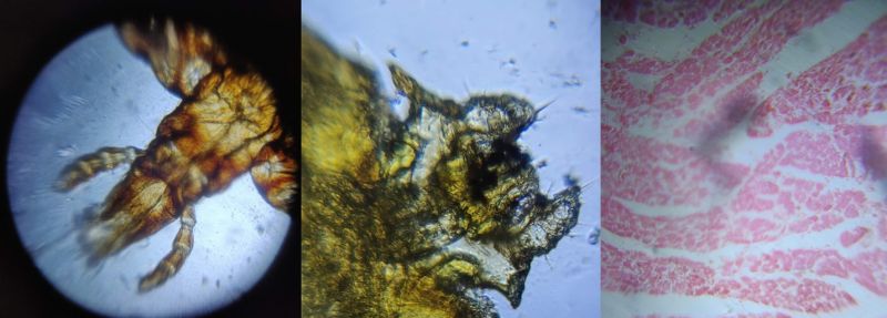 Different varieties of ticks and animal tissue samples observed under a Foldscope.